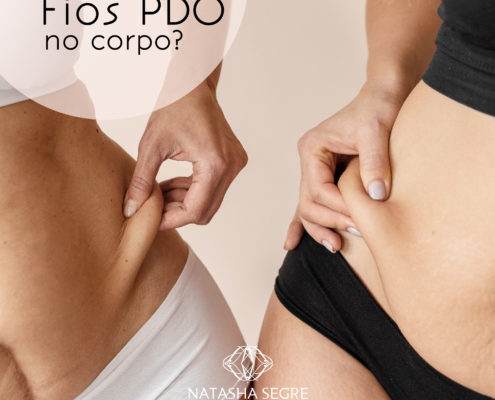 Fios PDO no corpo?