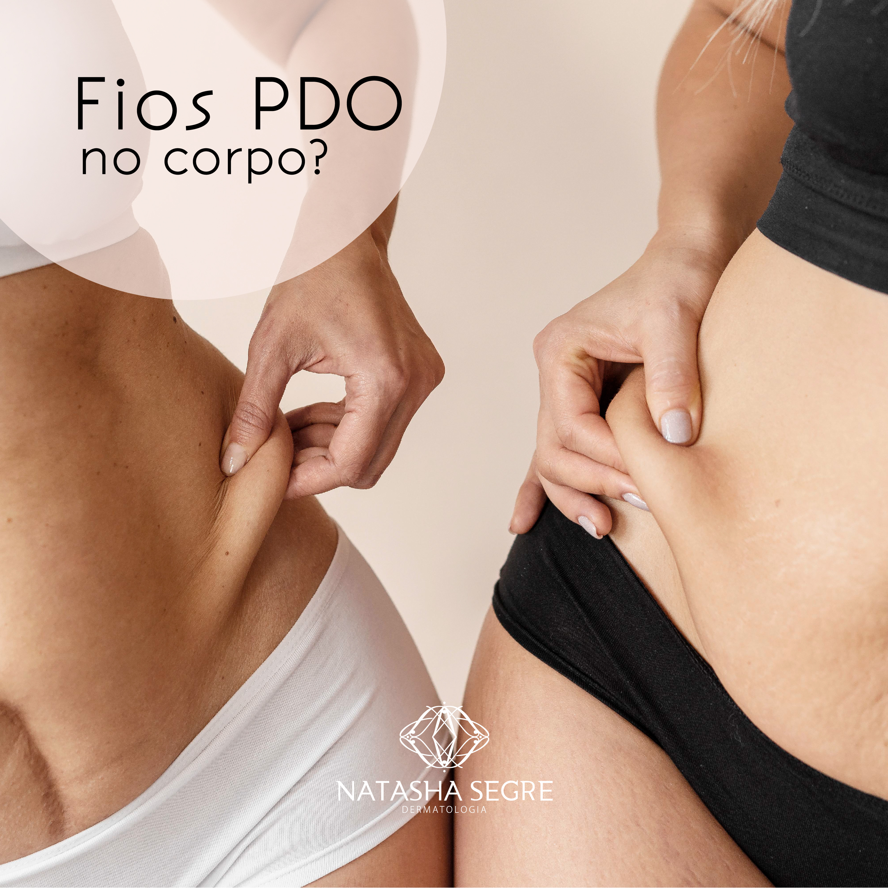 Fios PDO no corpo?